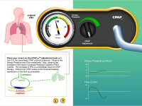 EMT CPAP-OS